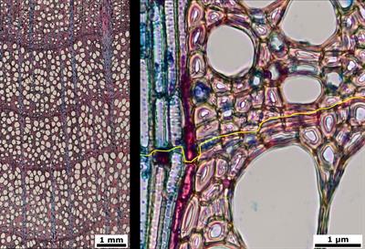 Tree ring segmentation using UNEt TRansformer neural network on stained microsections for quantitative wood anatomy